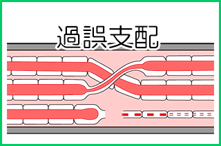顔面神経麻痺:病的共同運動